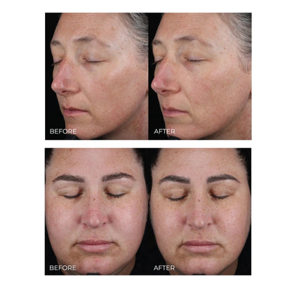 Deluxe Night Cream 50 ml - Lifood Swiss